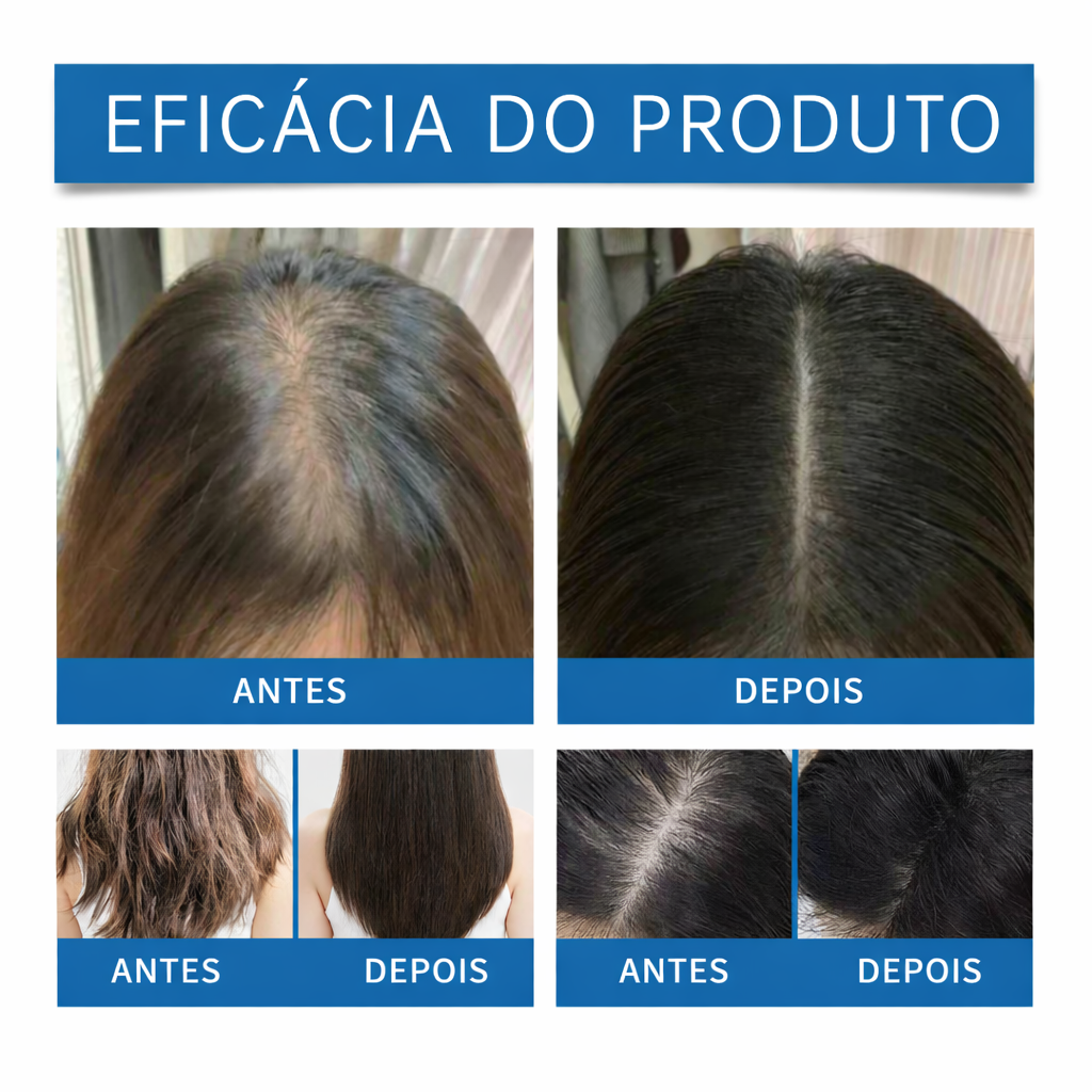 TrendHair Force -  SÉRUM PARA CRESCIMENTO CAPILAR