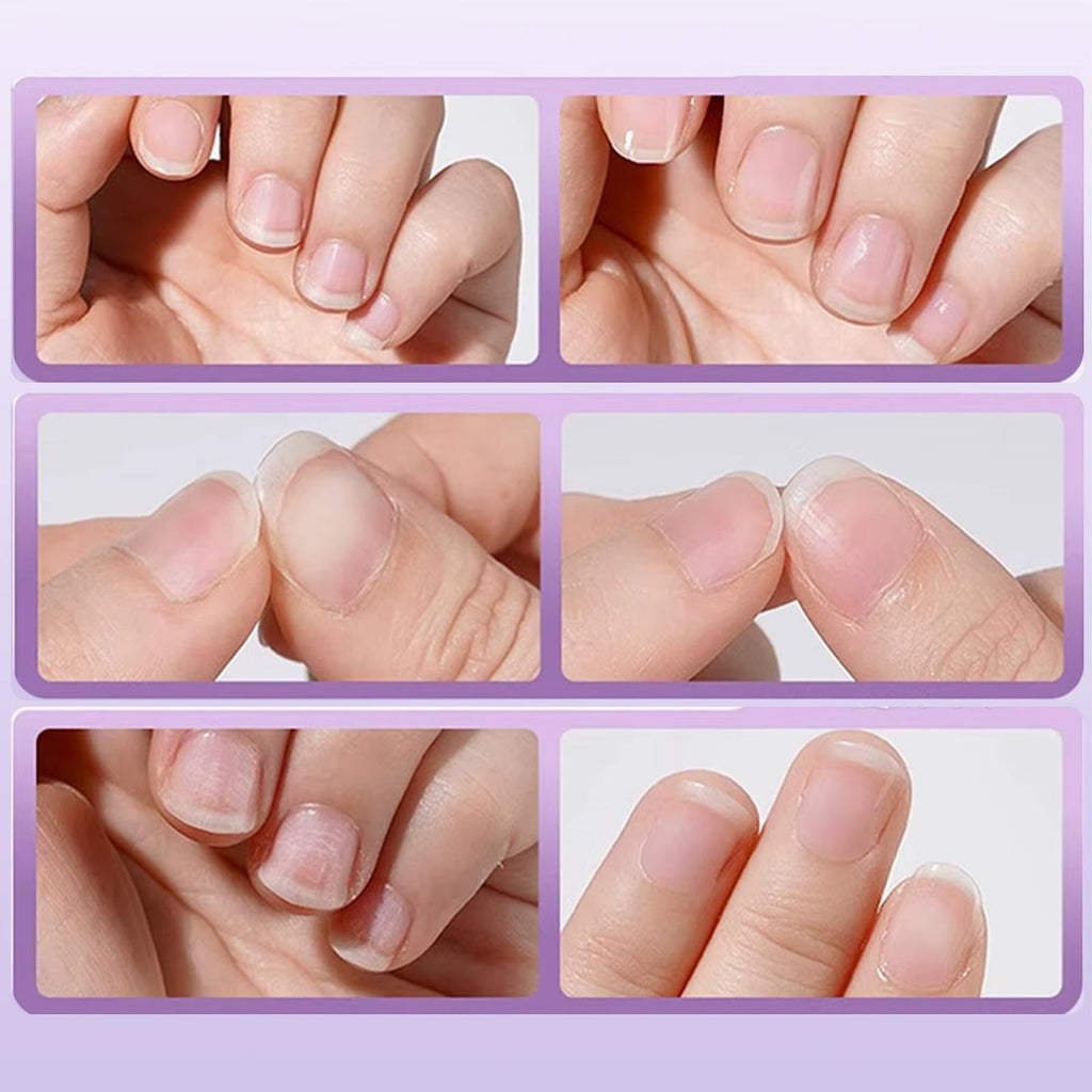NailCare™ - Tratamento Profissional