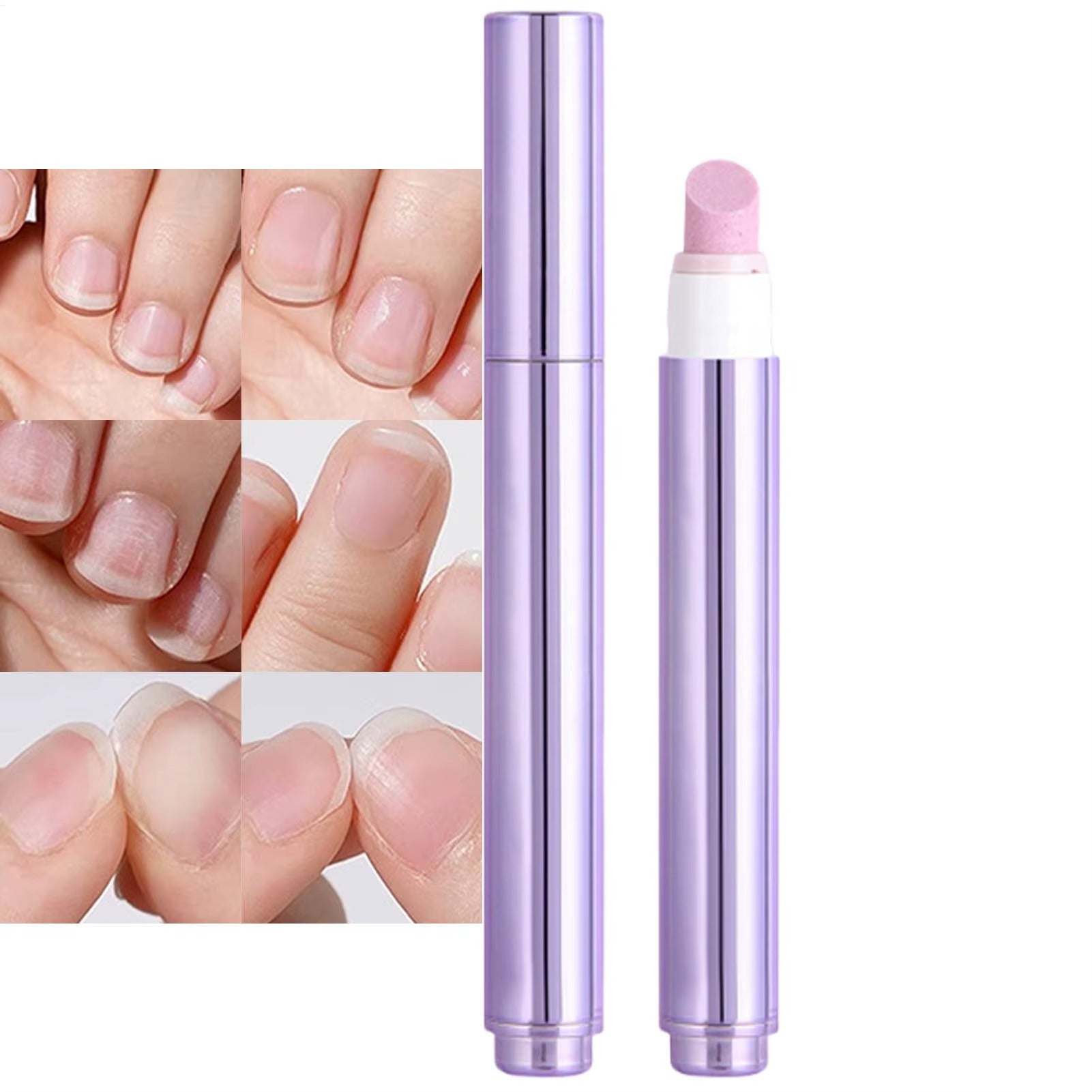 NailCare™ - Tratamento Profissional