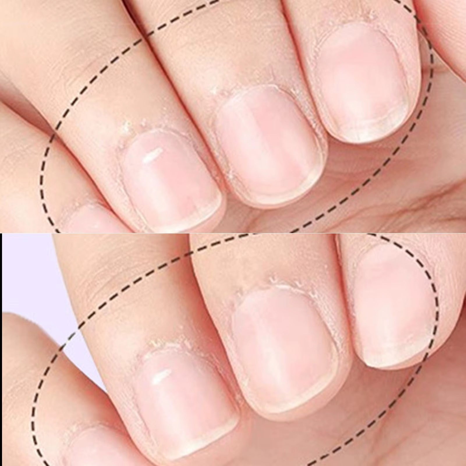 NailCare™ - Tratamento Profissional