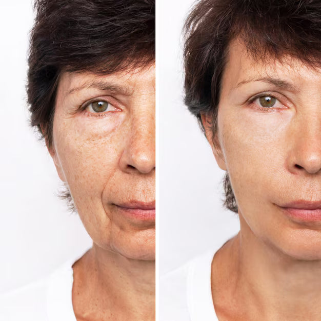 Caneta Lifting Instantânea - Trend+